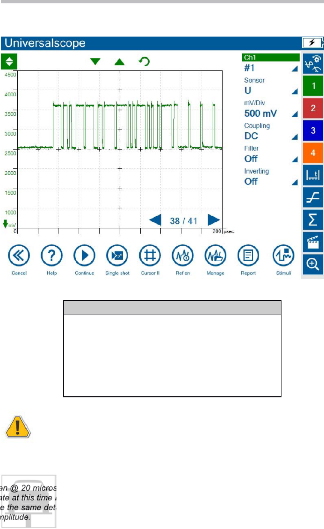Sample 7 of Technical Document ST1102 Advanced Vehicle Diagnosis Technical Manual [PDF]
